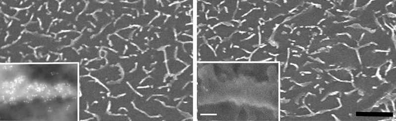 Scanning electron microscopy of human corneal epithelial cell cultures with 6 nm ImmunoGold