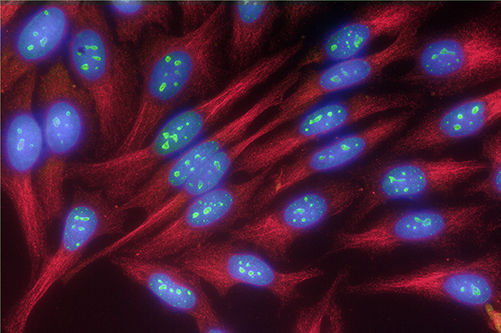 Double labeling of HEp-2 cells