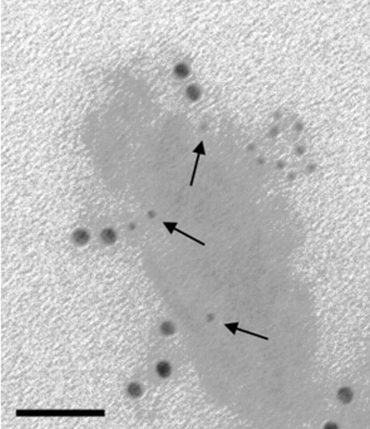 Electron Microscopy with ImmunoGold Reagents