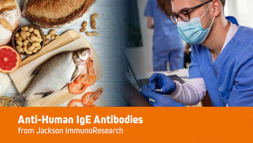 Thumbnail Preview of Anti-Human IgE Antibodies