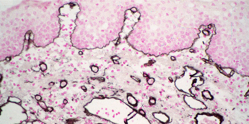 Colorimetric Immunohistochemistry