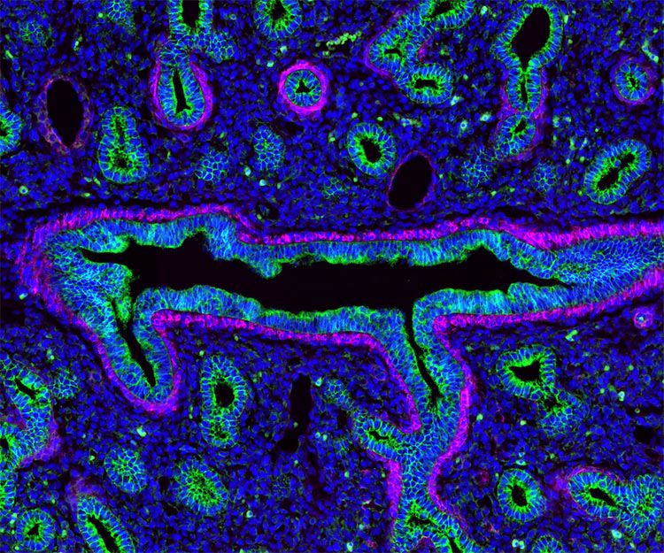 multiple labeling with AffiniPure-VHH™ Secondaries