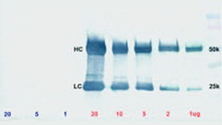 Thumbnail Preview of Light Chain Specific Antibodies For Western Blotting After Immunoprecipitation