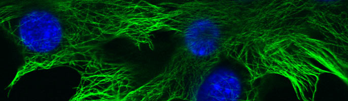 Cultured mouse mammary gland tumour cells 4T1. Formalin fixed cells stained with anti alpha tubulin. Alpha tubulin visualised with Alexa Fluor® 488 Goat anti Mouse IgG₁. Nucleus counterstained with DAPI.