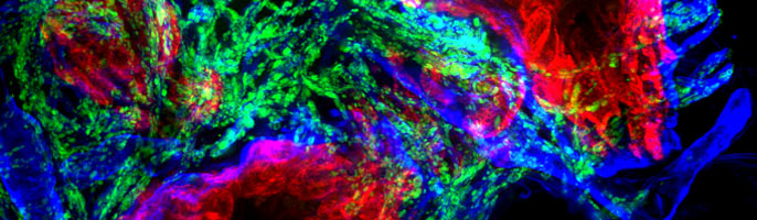 Skin sweat gland labeled with rabbit anti-PGP9.5 + donkey anti-rabbit Cy3, epithelial cells labeled with rat anti-CD44 + donkey anti-rat Cy3 & basement membranes labeled with goat anti-collagen IV + donkey anti-goat Cy5