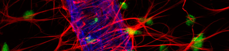 IF beeld van rat retinaal weefsel gevisualiseerd met JIR Alexa Fluor®-geconjugeerde secundaire antilichamen