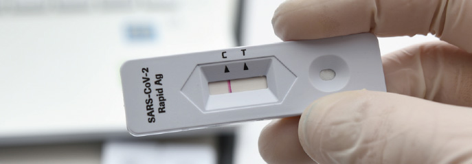 SARS CoV 2 Rapid Antigen Test