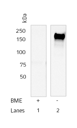 Western blot showing detection of purified human IgE by Jackson ImmunoResearch Anti-Human IgE in reducing and non-reducing conditions.
