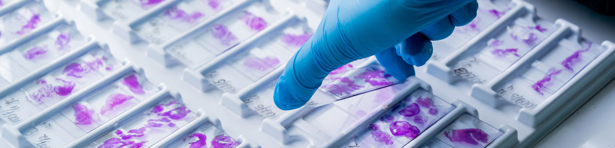 Hand in blue glove holding glass histology slides