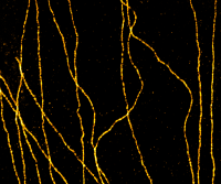 Super-Resolution Microscopy: Principles, Technologies, and Considerations for Reagent Selection