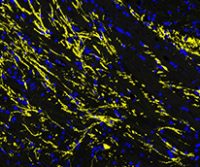 Considerations for Multiplex Immunofluorescence