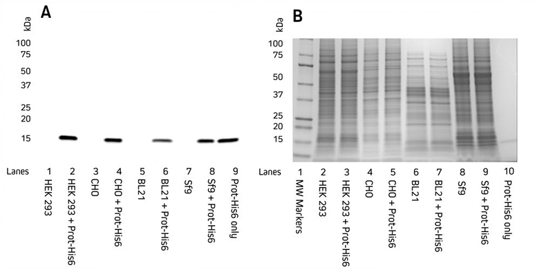 Western blot coomassie anti his