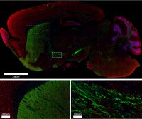 Focus: Imaging with AffiniPure-VHH® Secondary Antibodies
