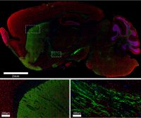 Focus: Imaging with AffiniPure-VHH™ Secondary Antibodies