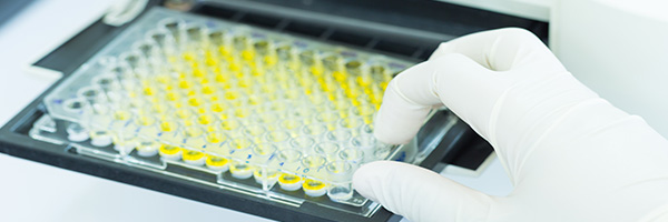 Gloved scientist setting up ELISA plate reader