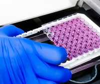 ELISA Guide; Part 2: The ELISA Protocol