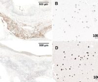 Chromogenic Detection for Western Blot, IHC, and ELISA