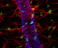 An Introduction to Expansion Microscopy