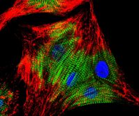 Cross-adsorbed secondary antibodies and cross-reactivity