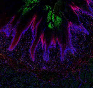  Hypoxic cells 