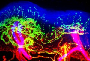 Epidermal Basement Membrane