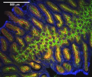 Human ileum mucosa 