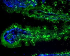 Jejunum villi neuroendocrine cells.