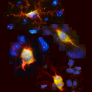 Oligodendrocyte progenitors 