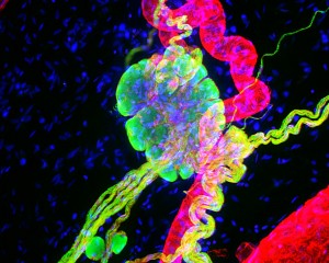 Nerve cell bodies and fibers.