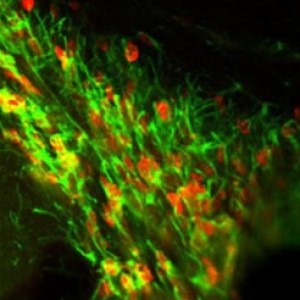 Astrocytes and neural stem cells