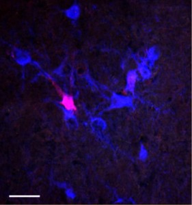 Retrograde labelling of sub-coeruleus neurones 
