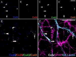 6 label IHC. Rat retina. 