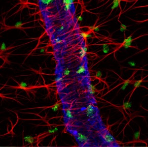 Triple label IHC! Retinal wholemount 