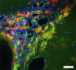 Astrocytes and neural stem cells