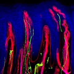 Gingival epithelium nerve fibres.