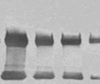 Chemiluminescent Western blotting