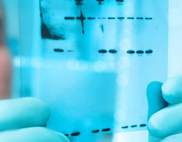 Gloved scientist observing a western blot film